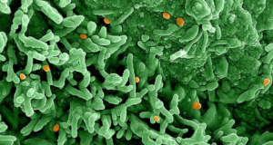 Nueva amenaza global: la mpox