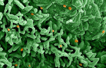 Nueva amenaza global: la mpox